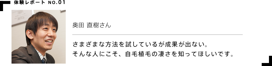 体験レポート 奥田 直樹さん さまざまな方法を試しているが成果が出ない。そんな人にこそ、自毛植毛の凄さを知ってほしいです。