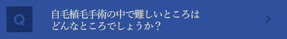 自毛植毛手術の中で難しいところはどんなところでしょうか？ 髪が生えているところへの移植は難しいです。