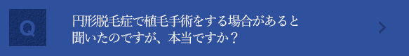 円形脱毛症で植毛手術をする場合があると聞いたのですが、本当ですか？