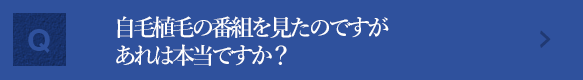 MXテレビで自毛植毛の番組を見ました。あれは本当なのですか？