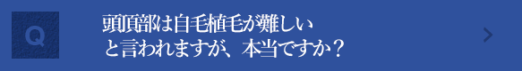 頭頂部は自毛植毛が難しいと言われますが、本当ですか？